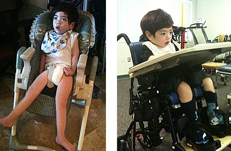 Before and after pictures showing first a boy sitting uncomfortably in a chair with no supports and then positioned comfortably in adaptive seating equipment